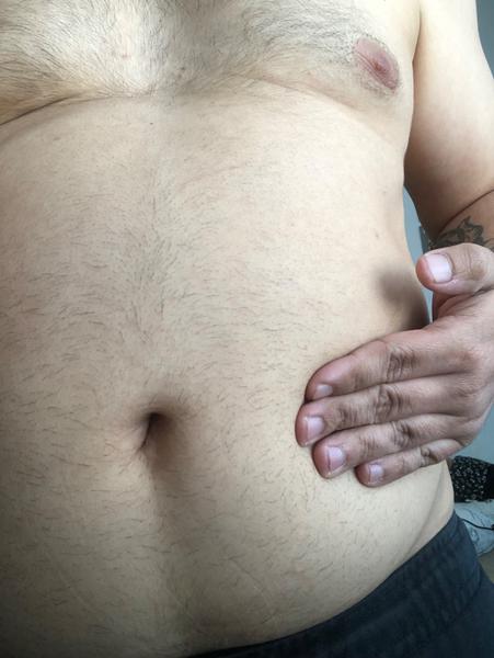 Čo spôsobuje čudnú bolesť brucha na ľavej strane?