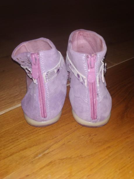 Sandále, protetika,35