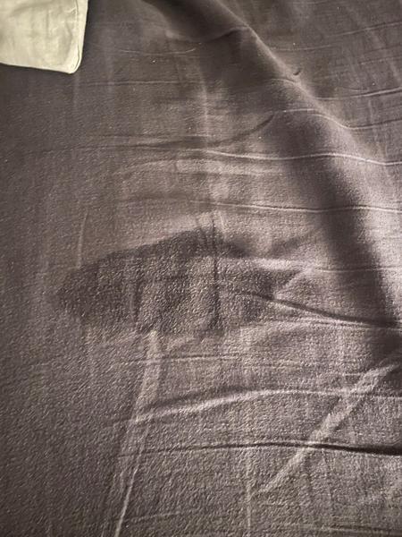 Tvrdnutie brucha a únik plodovej vody: Skúsenosti mamičiek