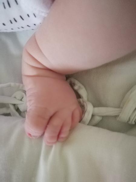 Dajú sa oddeliť spojené prsty na nohách?