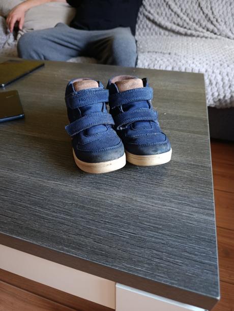 Topanky, protetika,28