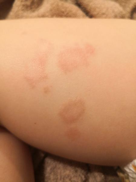 Čo to má moje dieťa na nohách?