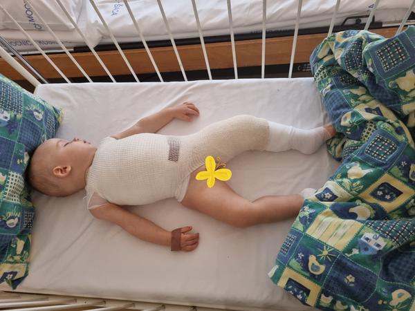 Nemocnica Košice - popláleniny