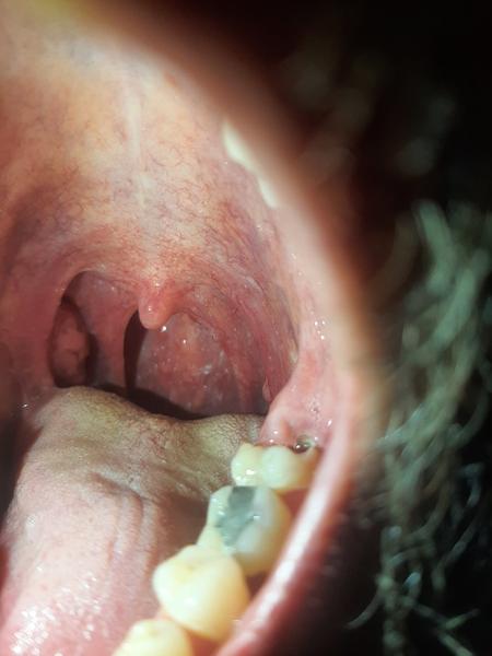 Je na mojom hrdle viditeľný nejaký nezvyčajný problém?