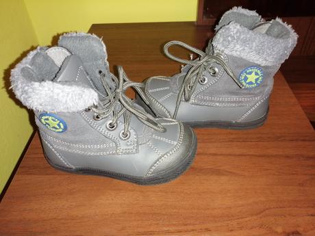 Čižmičky  protetika, protetika,21