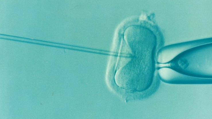 Komplikácie pri IVF