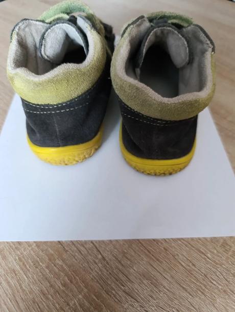 Barefoot protetika, protetika,31