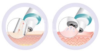 Medel dermo peel - microdermabrázia,