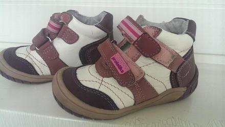 Topanky, protetika,22