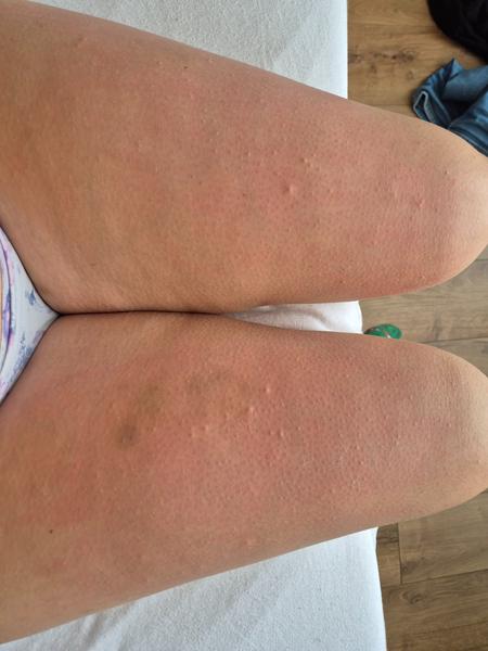 Príčiny svrbenia pokožky a neúčinných liečebných metód