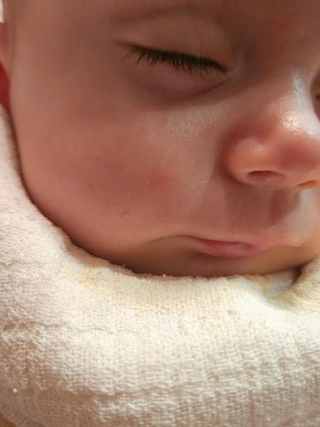 Čo mohlo uštipnúť moje bábätko?