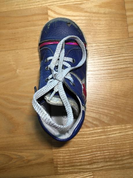 Protetika topánky, protetika,25