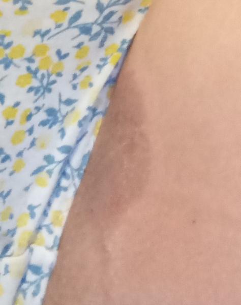 Môže to byť zaparenina?