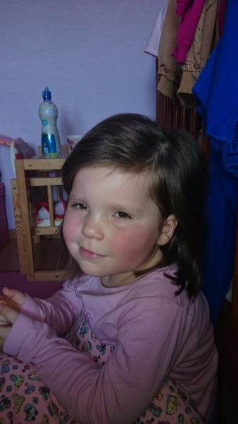 Alergia u trojročného dieťaťa