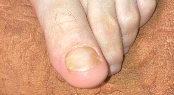 Čo to mám na palci?