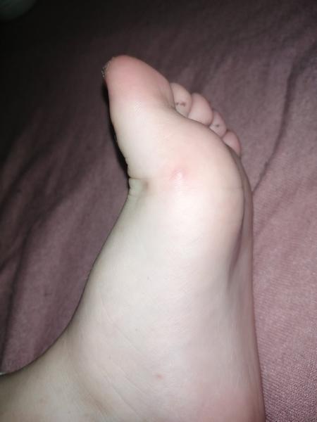 Sú to kiahne alebo nie?