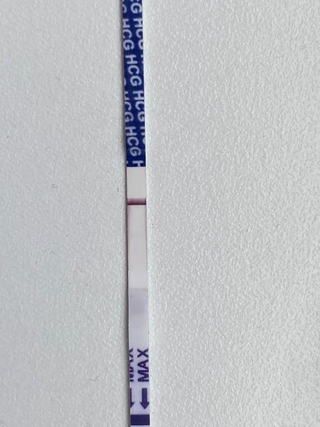 Je to kanálik alebo čiarka?