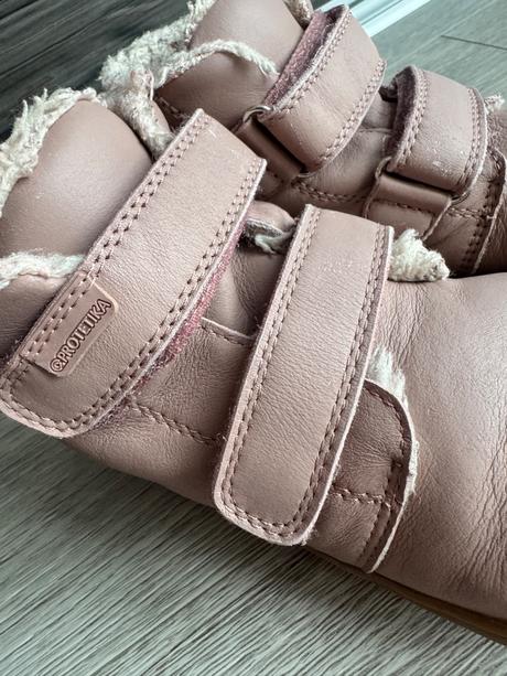 Zimne topanky protetika barefoot, protetika,29