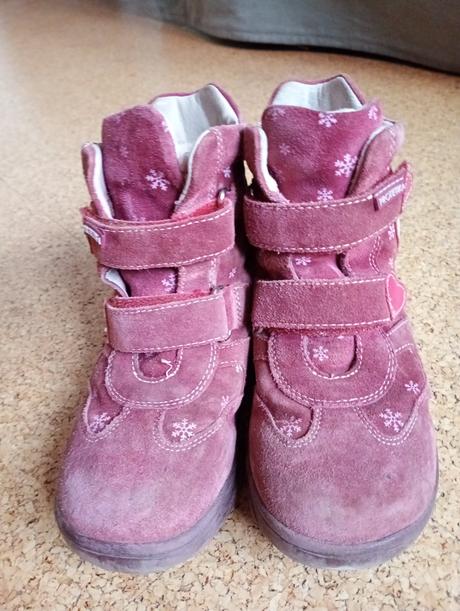 Čižmy protetika, protetika,31