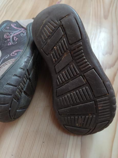 Dievcenske topanky protetika, protetika,22