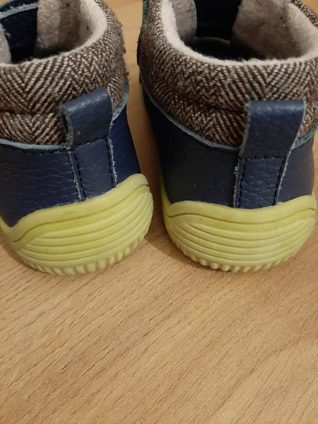 Celorocne topanky protetika, protetika,21