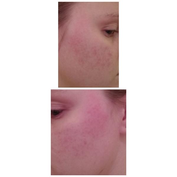 Neviete mi poradiť? Je to ekzém?