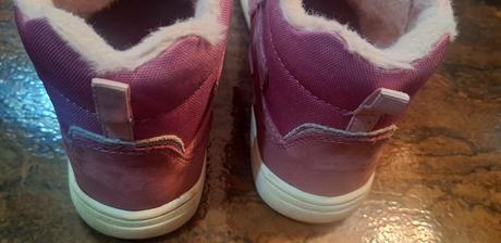 Protetika daxi pink, protetika,33