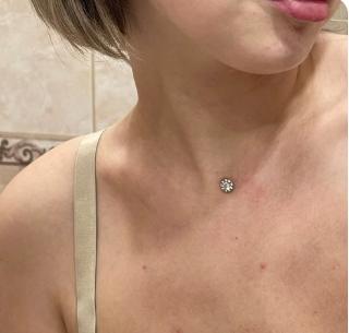 Podkožný titánový implantát "microdermal" kvetinka,