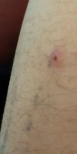 Bolo to znamienko alebo nie?