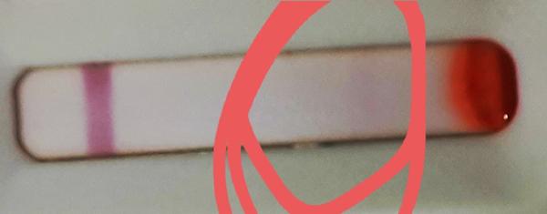 Krvný rýchlotest IgG/IgM - Covid-19