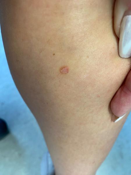 Citlivejšie znamienko