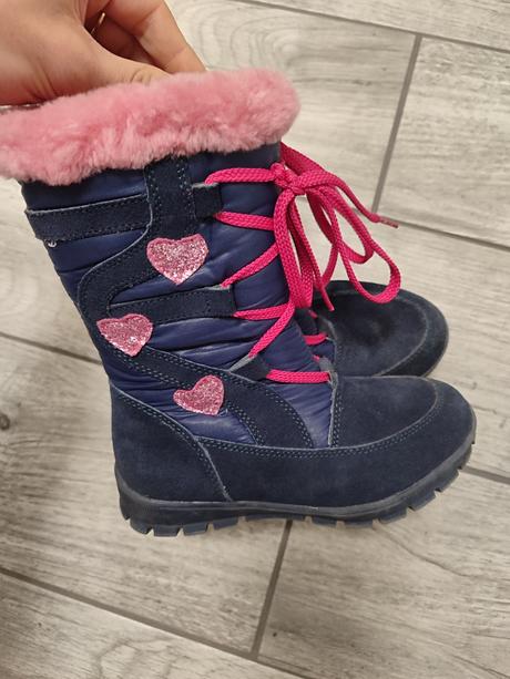 Zimné čižmy, protetika,28