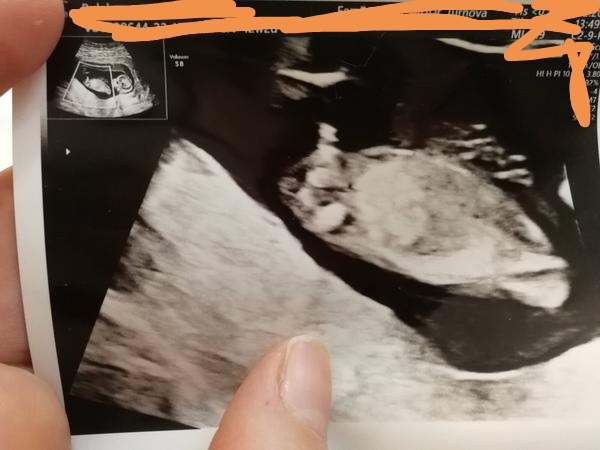 Aké je to pohlavie?