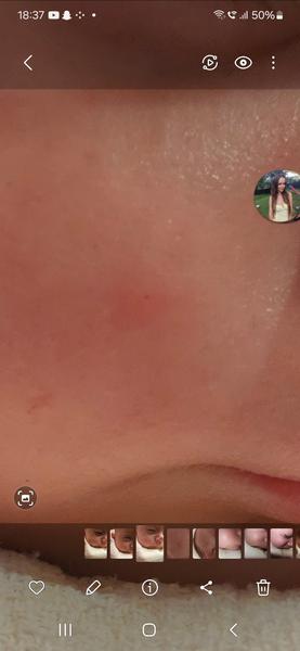 Čo mohlo uštipnúť moje bábätko?