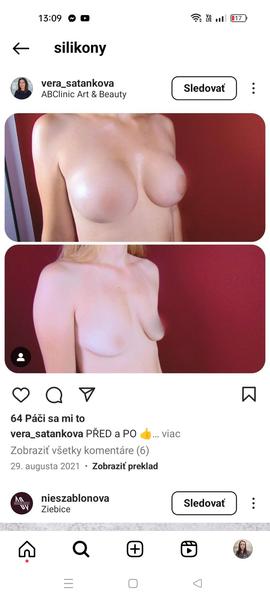 Nevystužené podprsenky s kosticami pre vykojené prsia