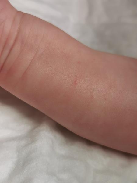 Čo to má syn na ruke?