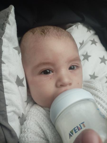 Prečo sa synčekovi robia pri pití mlieka červené fľaky?