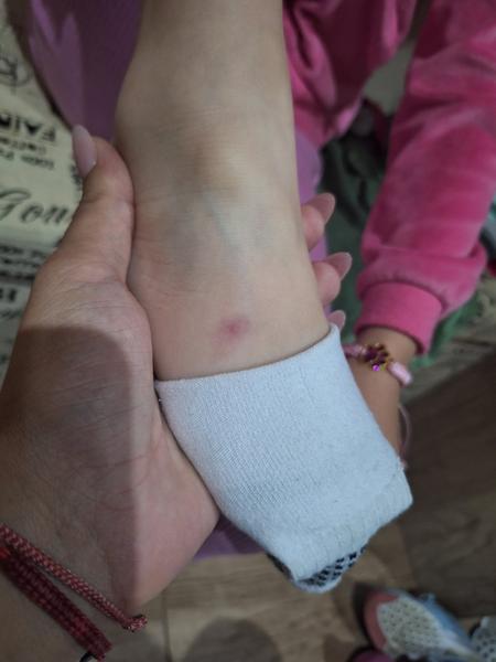 Čo robiť s nevysvetliteľnou vyrážkou na nohe dieťaťa?