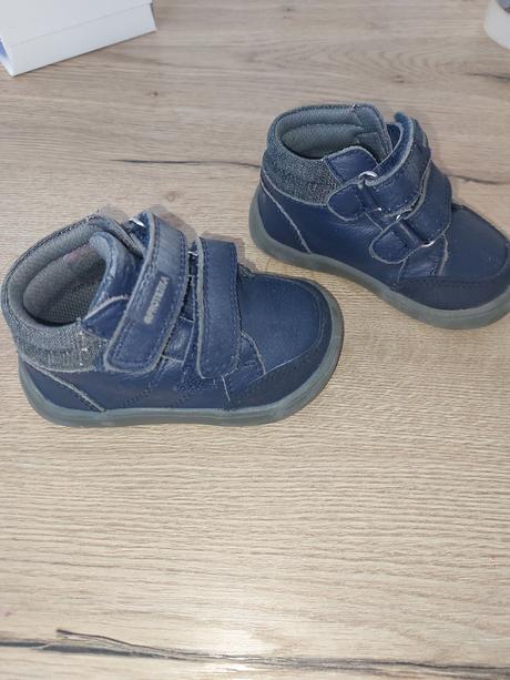 Prechodne topanocky protetika, protetika,19