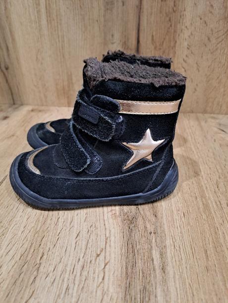 Topánočky protetika, protetika,24