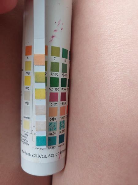 Hemoglobín u 5-ročnej dcéry