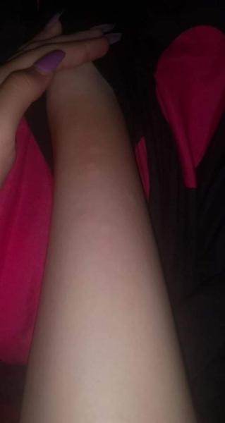 Môže byť toto komár?