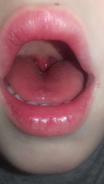 Čo to môže byť za chorobu?