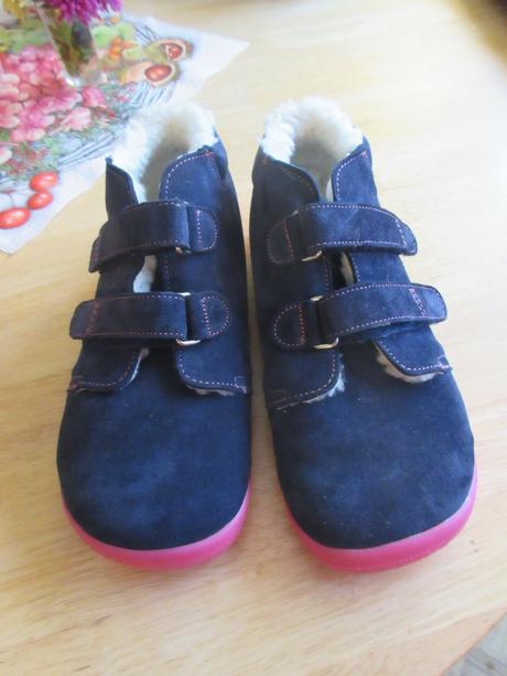 Zimne beda clenkove, beda,36