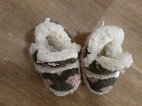 Papucky ruzove, deichmann,17