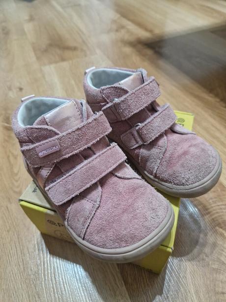 Protetika celoročky, protetika,26