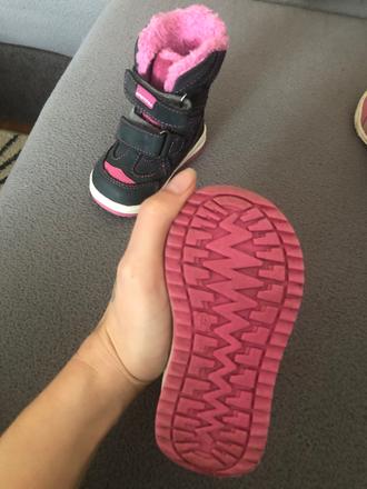 Detcké protetika čižmičky, protetika,19