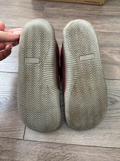 Protetika prechodné topánky, protetika,33