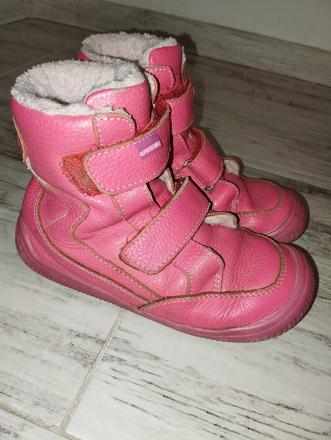 Protetika zimne, protetika,29