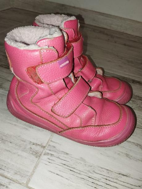 Protetika zimne, protetika,29